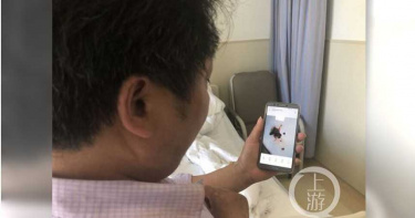大陸重慶男子狂咳以為罹癌 檢查發現竟是「這個」作怪!