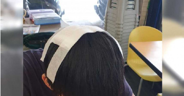公車站牌眼神交會被罵「看三小」 國中生慘遭打破頭