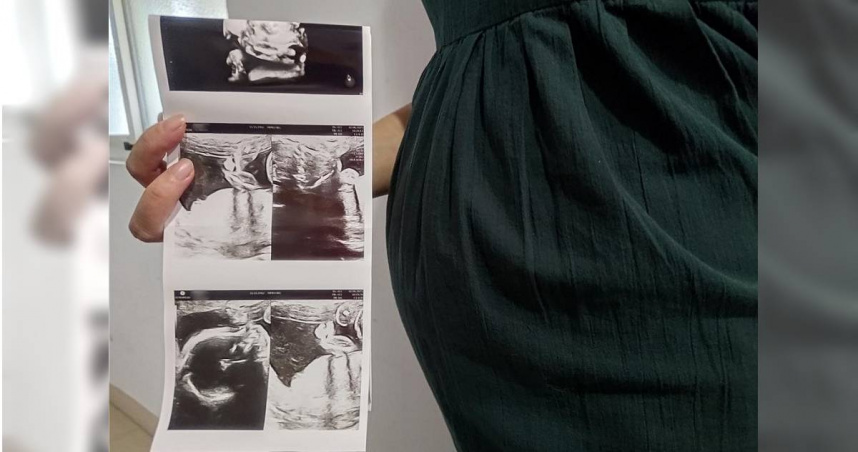 台北一家中醫診所在社群平台發布影片宣稱，懷孕或準備懷孕時不能吃麵食，胎兒可能心跳停止，遭多位婦產科醫師打臉，引發爭議。（示意圖／中國時報記者王家瑜攝）