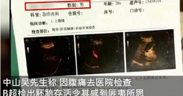 男腹痛就醫…超音波竟查出「宮內早孕」 真相曝光網笑翻
