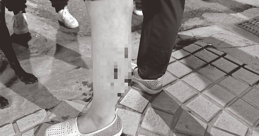 新北市蘆洲區3月22日晚間發生一起寵物犬攻擊事件，被害人小腿遭狗撕咬，鮮血直流。（圖／蘆洲警分局提供／中國時報張鎧乙新北傳真）