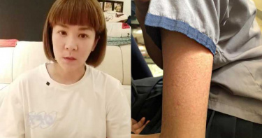 女兒裙子太短!遭男師偷拍「拉扯手受傷」 陸元琪直播揭校方惡行