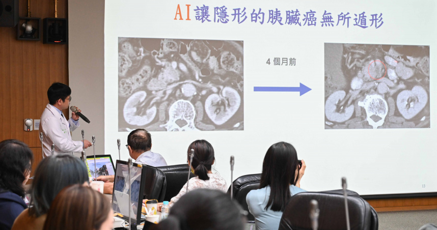 台大醫院與台灣大學應用數學科學研究所合作，開發出AI胰臟癌輔助診斷系統。（圖／台大醫院提供）