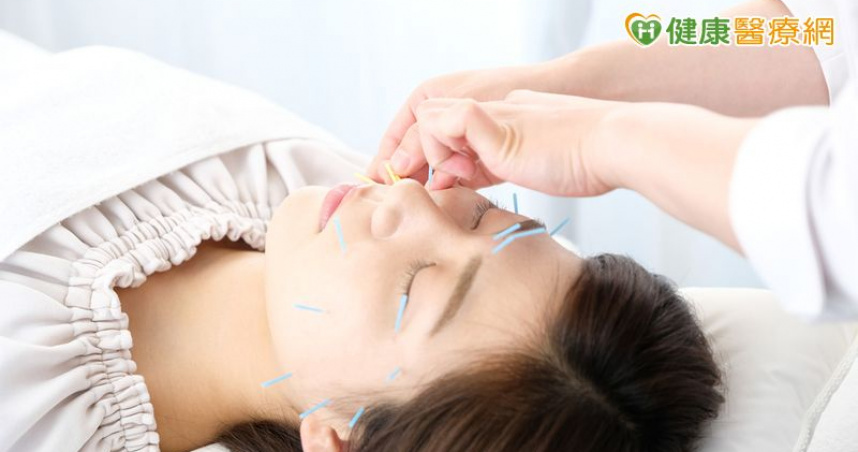 不動刀也能改善　中醫美顏針從肌肉與經絡著手