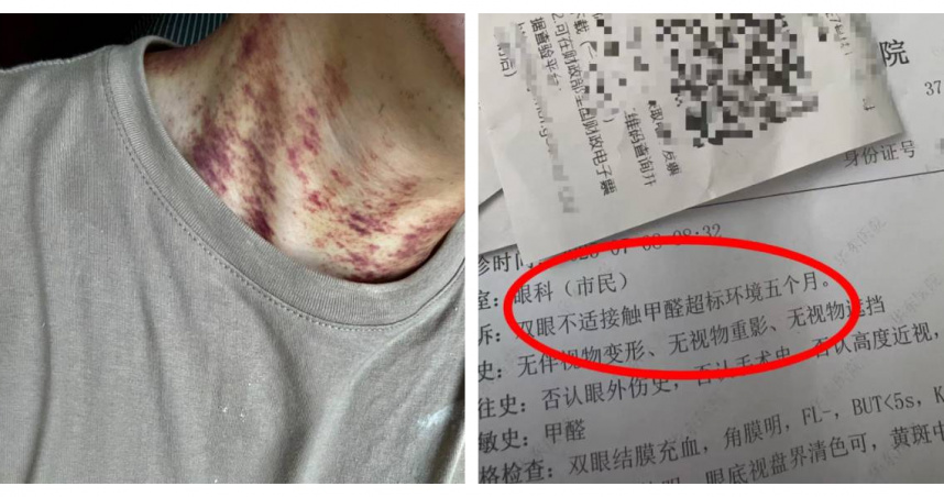 馬先生自曝在杭州承租豪宅，入住後健康急轉直下。（圖／瀟湘晨報，下同）