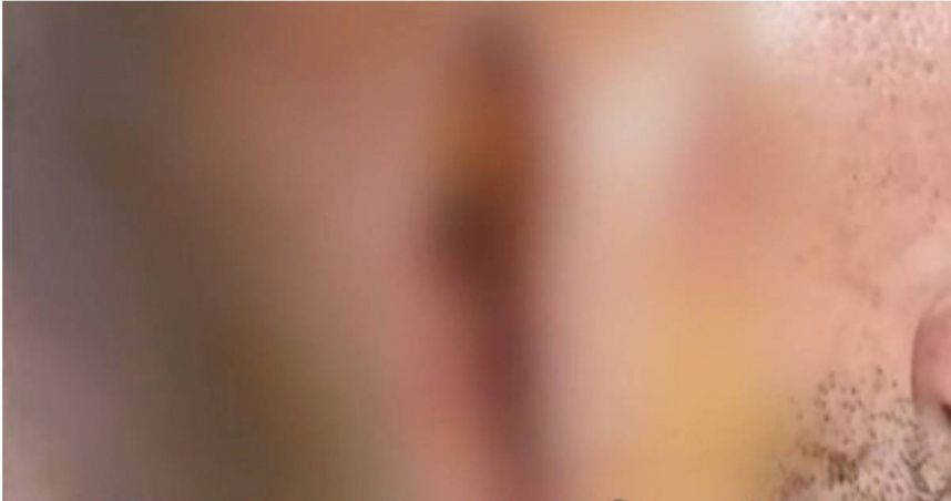 胡姓男子被狗狗攻擊，遭咬穿了臉。（圖／翻攝畫面）