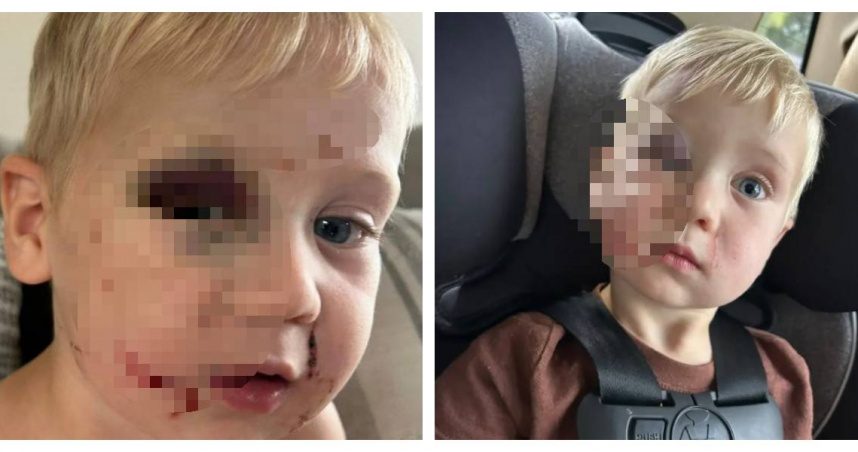 1歲男童克雷威克斯s臉部多處瘀傷與抓痕，其父公開照片要求司法給予公正交代。（圖／翻攝自FB，Cory Weeks）