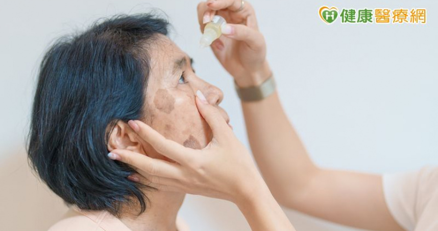 眼藥水也可能誘發氣喘　食藥署說明原因