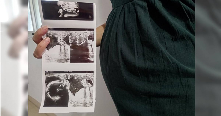 國民健康署提醒，「性別篩選」是違法行為，民眾如有發現疑似情事，可撥打性別比查報專線或向地方衛生局反映。圖為懷孕示意照。（圖／中時記者王家瑜攝）