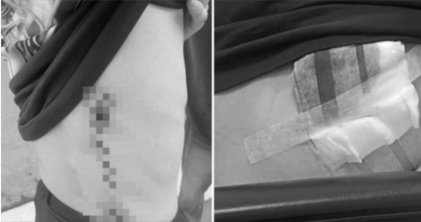 韓國申姓留學生5日驚傳只因對到眼無故遭人砍傷。（圖／翻攝自Threads @chalongwu）