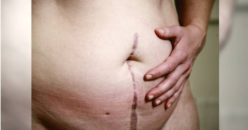 中國一名59歲婦女每天都要進行12小時的採茶工作，結果某天工作時，下體突然感覺到有一個東西掉出來。（示意圖／Unsplash）