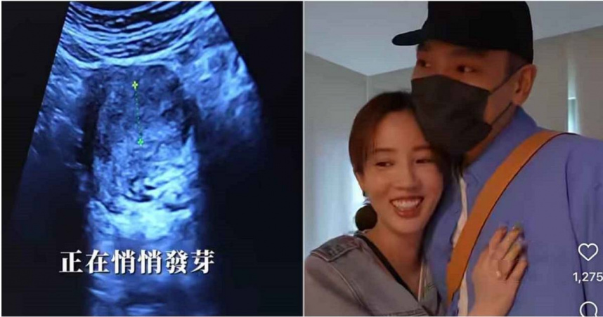 愛雅宣布懷孕！開心喊：她毫無預警地闖進我的生命