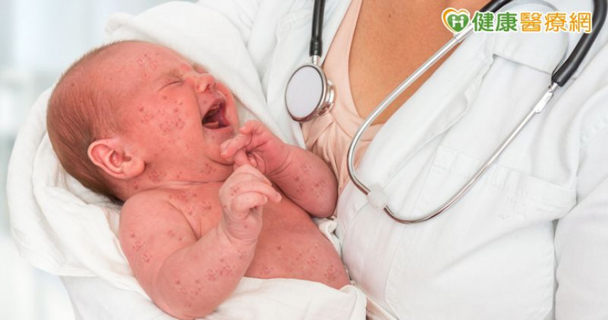 腸病毒重症創近6年同期新高　新生兒病例佔多數