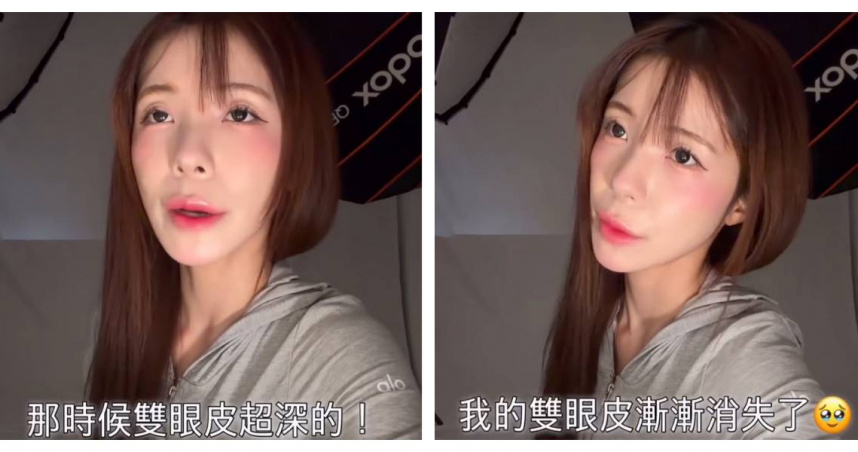 李多慧突喊「完蛋了」！天生雙眼皮變淡　首動整形念頭