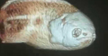 男子腹痛就醫:不小心坐到!X光一照「完整吳郭魚」 濃腐臭味讓護士狂吐