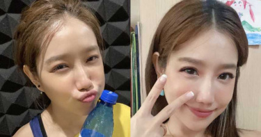女星驚爆染性病?臉狂長「肉色疹子」做臉師傅嚇壞:是菜花 醫師揭真相