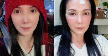 丁國琳年前出意外!女神臉「破相縫5針」 憔悴模樣粉絲超心疼