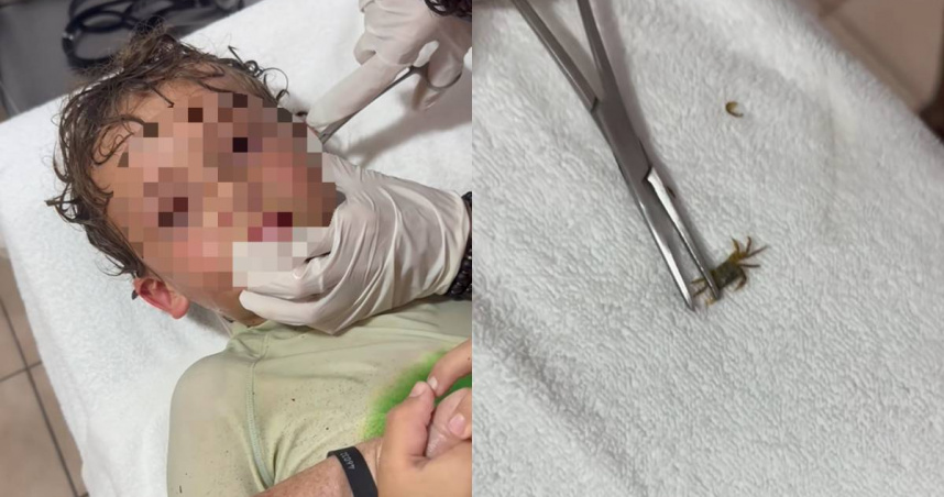 醫生從佩德羅的耳朵裡夾出一隻小螃蟹。（圖／翻攝自TikTok／kitziamitre）