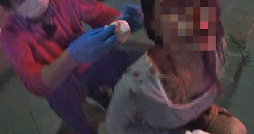 嘉義自小客失控狂撞停放車，19歲女滿臉鮮血送醫搶救。（圖 ／翻攝畫面）