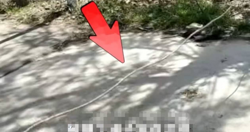 河南13歲男童騎車途中遭繩索勒頸，造成氣管與食道嚴重受傷。（圖／翻攝自極目新聞）