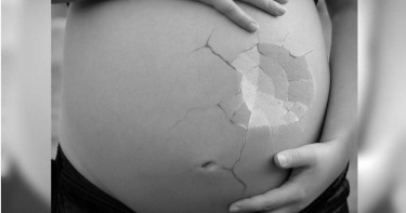 肚子油太厚「內臟爛掉」居然無感! 開刀還驚見「一堆糞便」