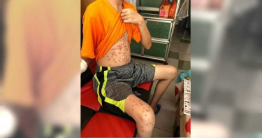 17歲少年遭雇主變態狂虐 射百發BB彈還逼吃屎