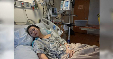 妙齡女吸電子煙「肺渾濁發白」 IG發勸世文警惕世人