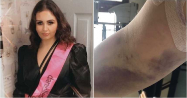 22歲嫩媽感冒隔天手臂莫名瘀青 就醫3天就病逝