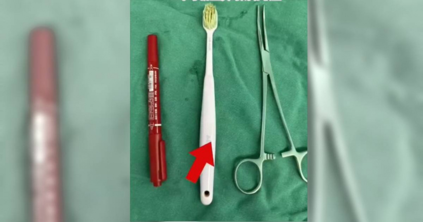 女子酒後催吐活吞「19公分牙刷」。（圖／翻攝畫面）