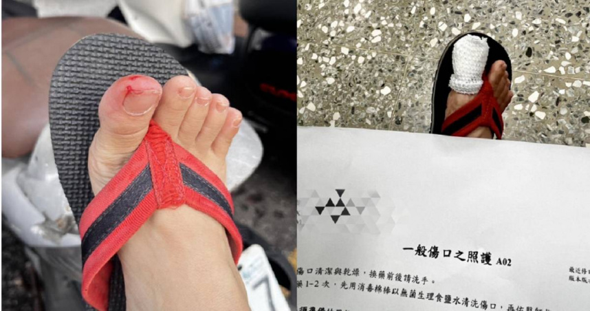 女子逛歸仁黃昏市場時遭老鼠咬傷腳趾頭，當場濺血，隨後就醫包紮並施打破傷風針。（圖／翻攝畫面）