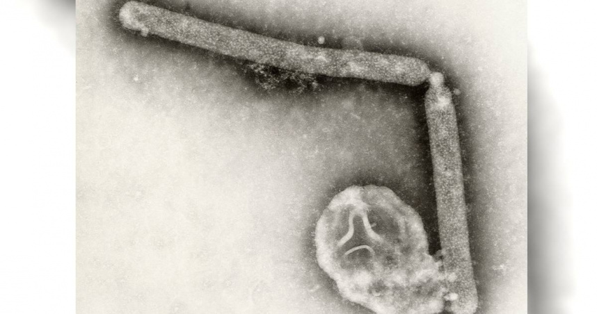 禽流感病毒。（圖／達志／美聯社）