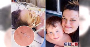 4歲童誤吞圖釘刺穿肺 腦缺氧急救3天不治