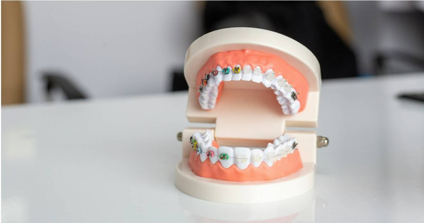 牙醫師Hank建議，民眾若想要洗牙，應該過年後再約。（示意圖／翻攝自unsplash）