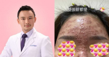 雷射完「滿臉一粒粒膿包」毀容!愛美女病患痛哭 永和醫氣炸揭真相