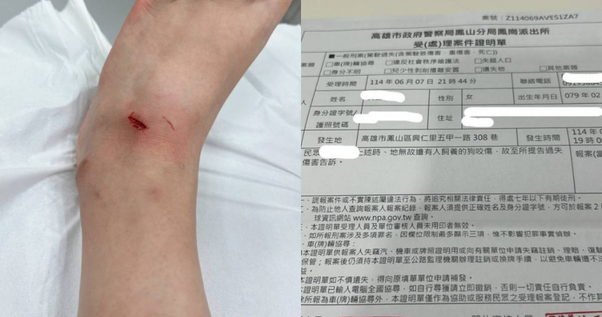 高雄一名女子控訴在路上被狗咬傷,飼主卻嗆「沒錢賠」。(圖/翻攝自爆料公社臉書)