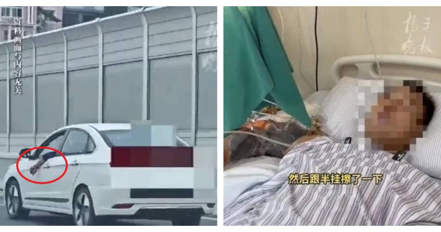 男子因手臂伸出車窗遭貨車擠壓，傷勢嚴重。（圖／翻攝自微博， 揚子晚報 ）