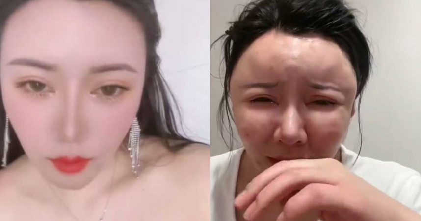 大陸湖北省武漢市近日傳出一起因違規醫美操作引發的嚴重事故。（圖／翻攝自微博）