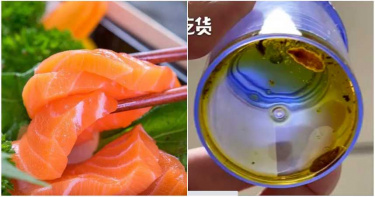 超愛鮭魚生魚片!婦人爽吃爆 4月後腹痛就診…醫驚:滿滿寄生蟲+卵