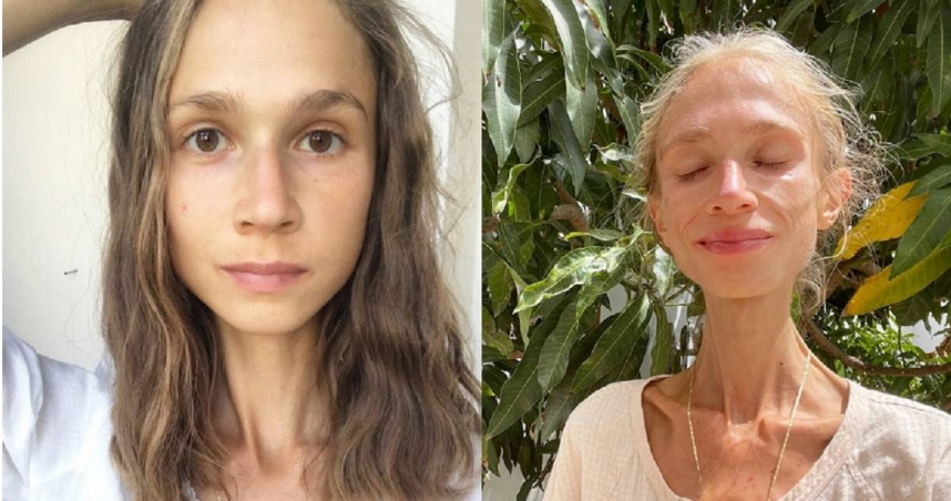 超極端素食者！27歲女只吃水果瘦成22kg紙片人出國玩竟活活餓死| 國際| CTWANT