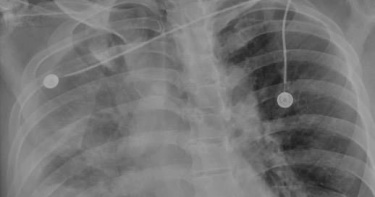 苗栗隨機砍人案，其中1名「正義男」被砍傷，病情嚴重。（圖／翻攝自馮啟彥臉書）