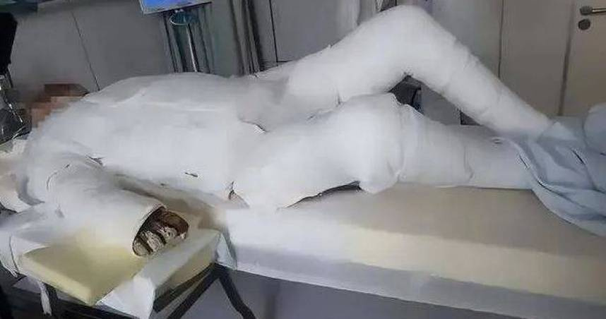 男大生全身90％燒傷。（圖／翻攝自微博）