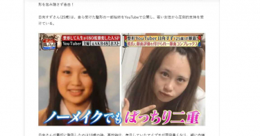 男友劈腿氣炸!櫻花妹大方認全臉整型 G罩杯沒動過刀