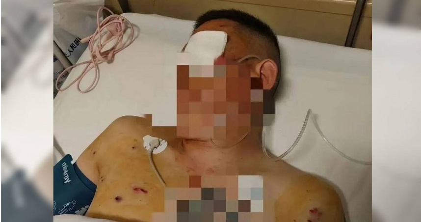 倪先生在銀行提領170萬元人民幣（約新台幣748萬元）後，於門口遭歹徒襲擊重傷。（圖／翻攝自彭湃新聞）