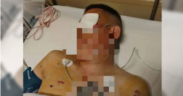 倪先生在銀行提領170萬元人民幣（約新台幣748萬元）後，於門口遭歹徒襲擊重傷。（圖／翻攝自彭湃新聞）