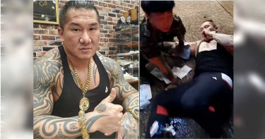 館長遭槍擊半年無法健身!肌肉恐「雪崩式塌陷」...恢復體格至少需2年