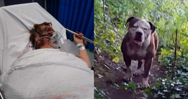 7旬老婦遭比特犬撕咬「斷指見骨」!心有餘悸:像獅子攻擊羚羊般可怕