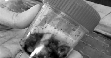 嘉義女拔20顆牙後死亡!家屬直呼「不可思議」 解剖結果出爐