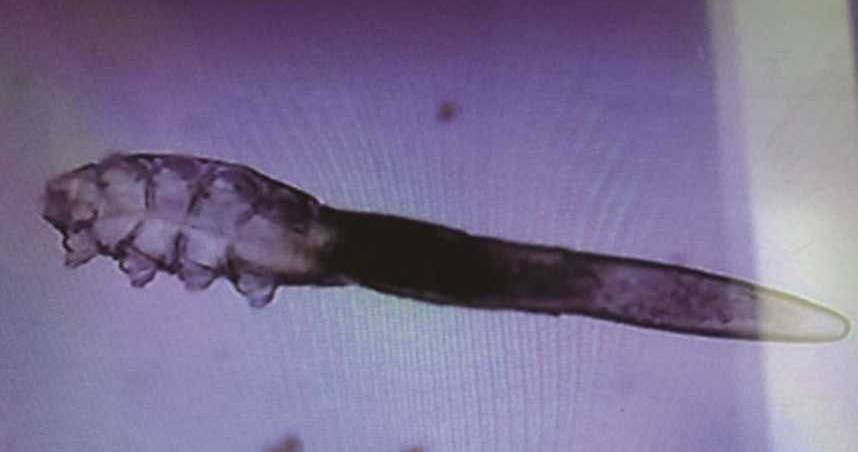 醫生初步判斷，張女患上了丘疹性蕁麻疹，而罪魁禍首很可能是涼蓆上滋生的蟎蟲。（示意圖／翻攝自溫州新聞網）