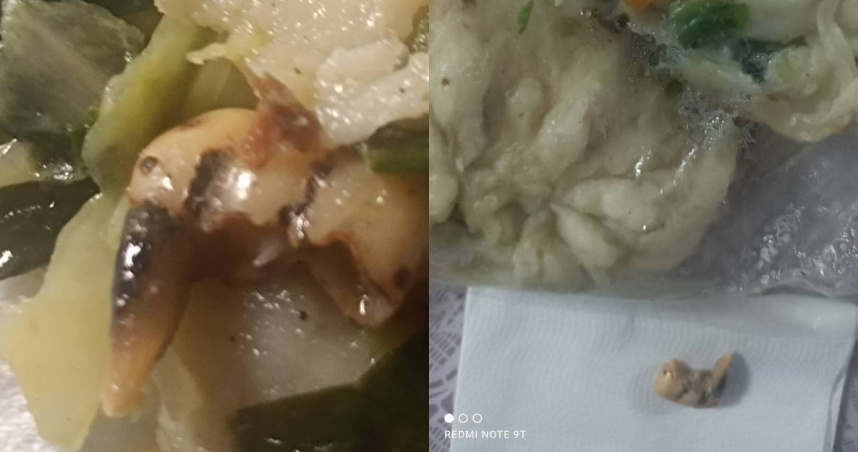 有民眾投訴吃水煎包吃到牙齒。（圖／翻攝臉書／台東大小事）