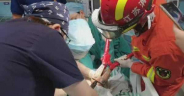 20月大男嬰玩耍不慎滾下床 後腦插進「15公分修腳刀」!